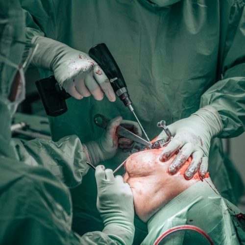 Orthopedic Surgeon Dallas Specializing in Joint and Bone Health